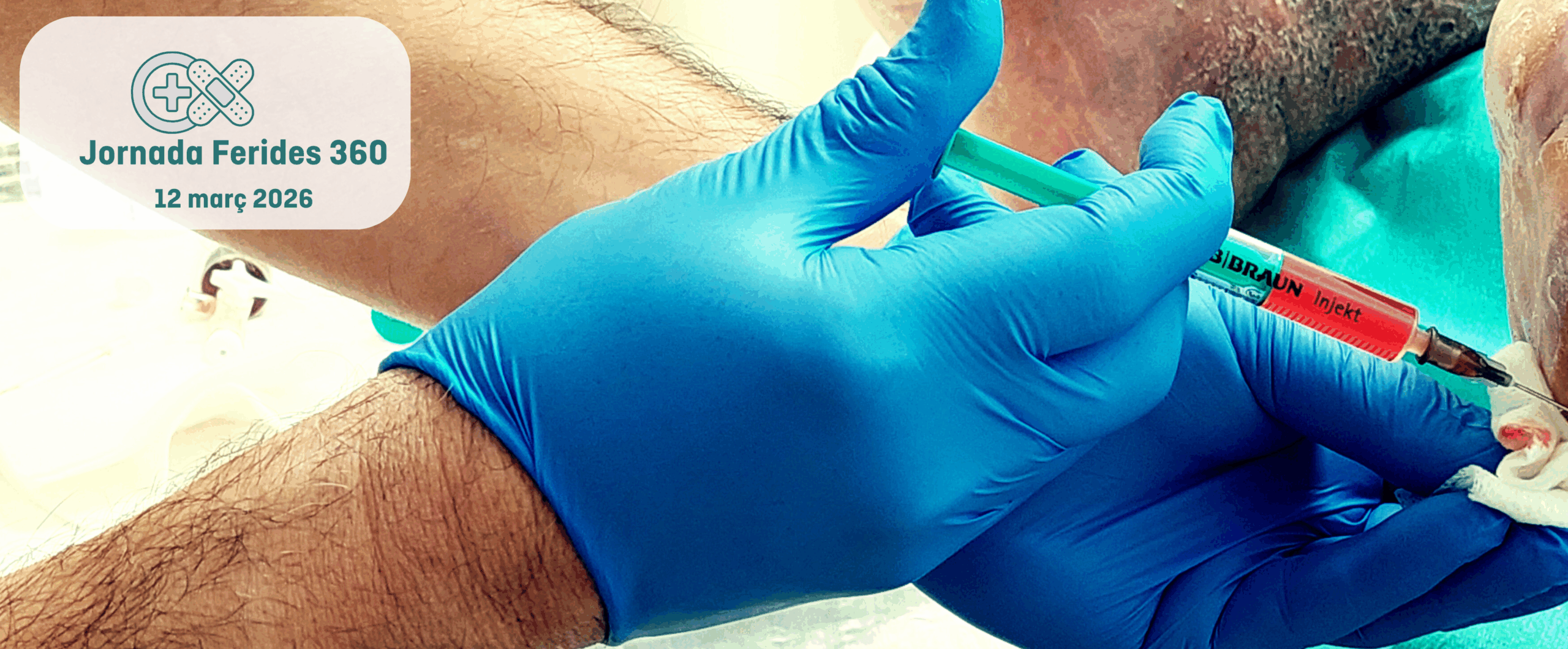Obertes les inscripcions per a la I Jornada Ferides 360